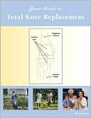 Fairview Health Services: Your Guide to Total Knee Replacement